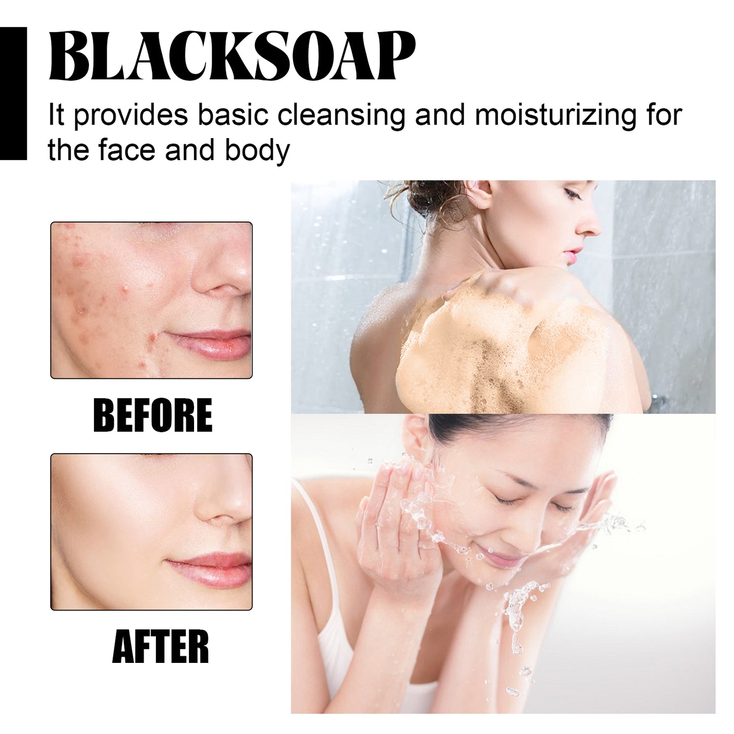 Shea Butter Black Soap for natural acne care and pore cleansing