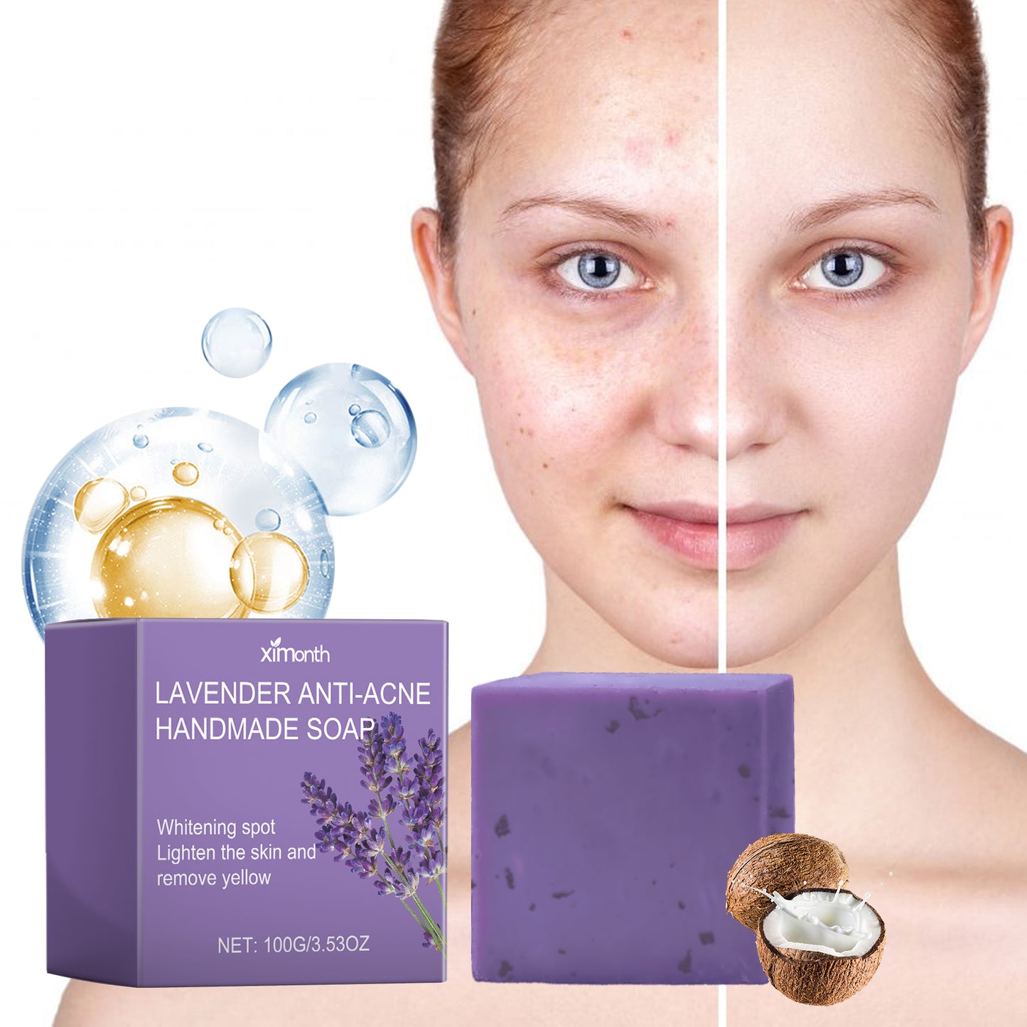 Lavender Oil Control Acne-Cleansing Soap for natural facial care