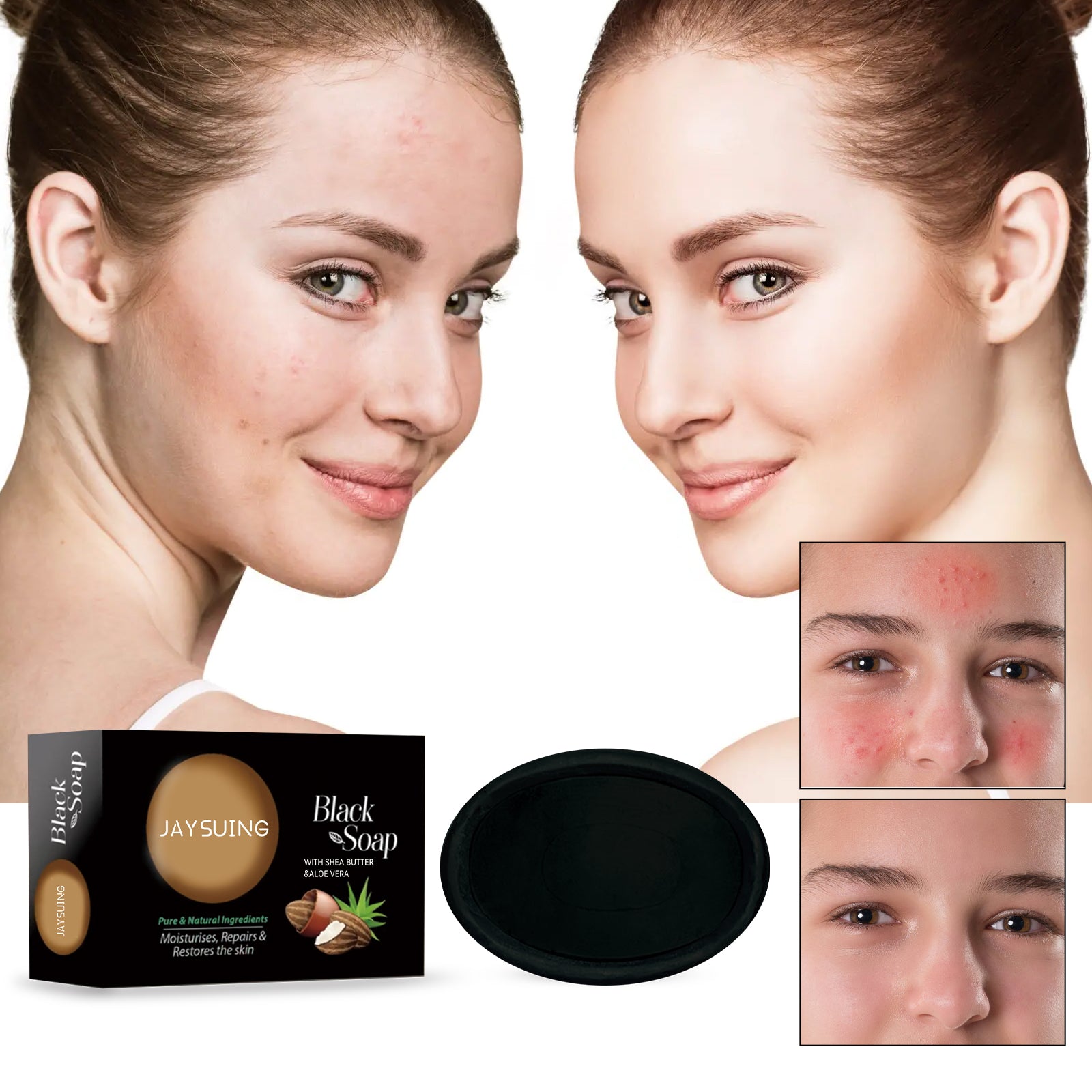 Shea Butter Black Soap for natural acne care and pore cleansing