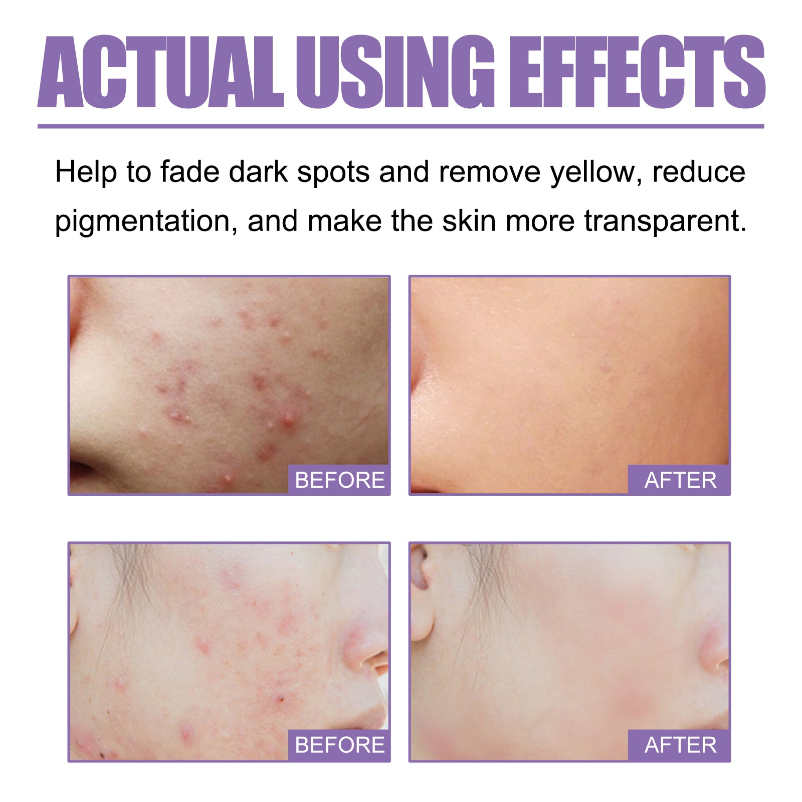 Lavender Oil Control Acne-Cleansing Soap for natural facial care